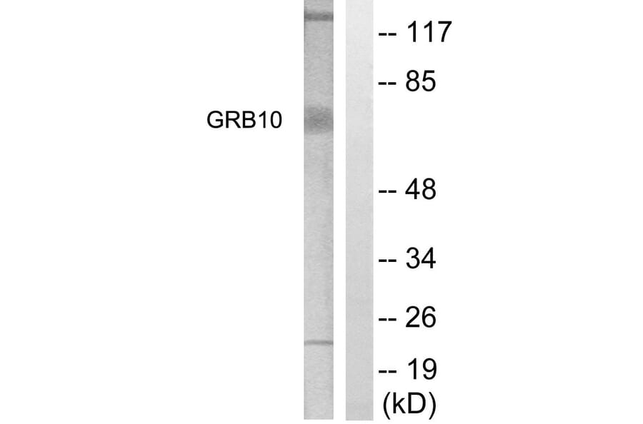 Western Blot - Anti-GRB10 Antibody (B1031) - Antibodies.com