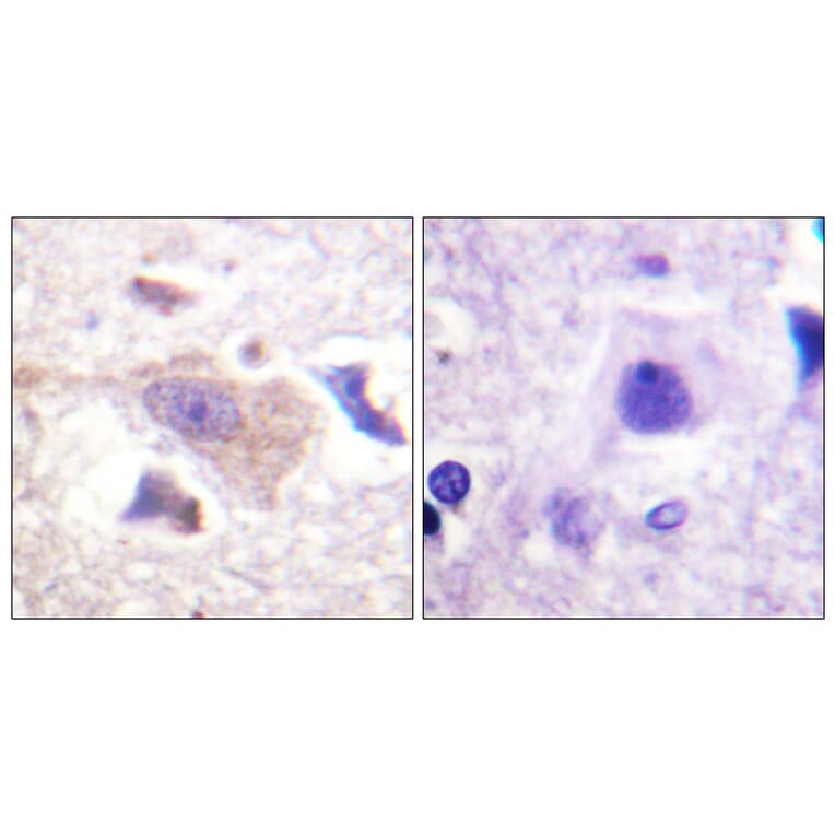 Immunohistochemistry - Anti-GRB10 Antibody (B1031) - Antibodies.com