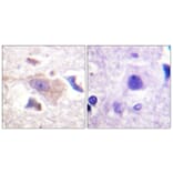 Immunohistochemistry - Anti-GRB10 Antibody (B1031) - Antibodies.com
