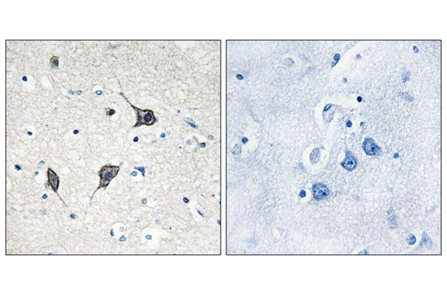 Immunohistochemistry - Anti-GPR20 Antibody (G328) - Antibodies.com