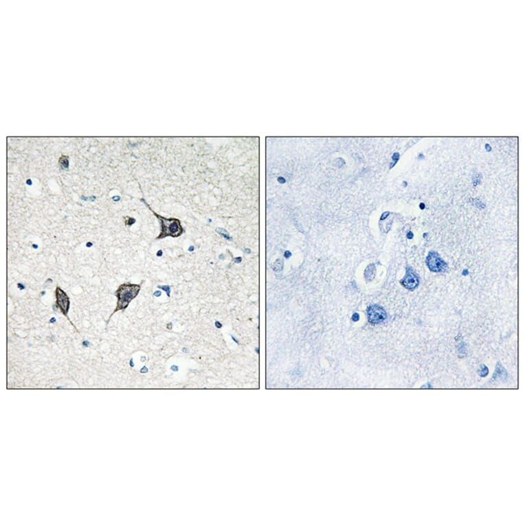 Immunohistochemistry - Anti-GPR20 Antibody (G328) - Antibodies.com
