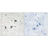 Immunohistochemistry - Anti-GPR20 Antibody (G328) - Antibodies.com