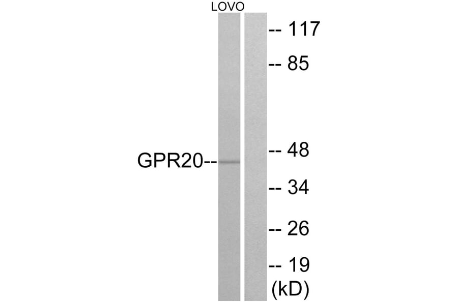 Western Blot - Anti-GPR20 Antibody (G328) - Antibodies.com