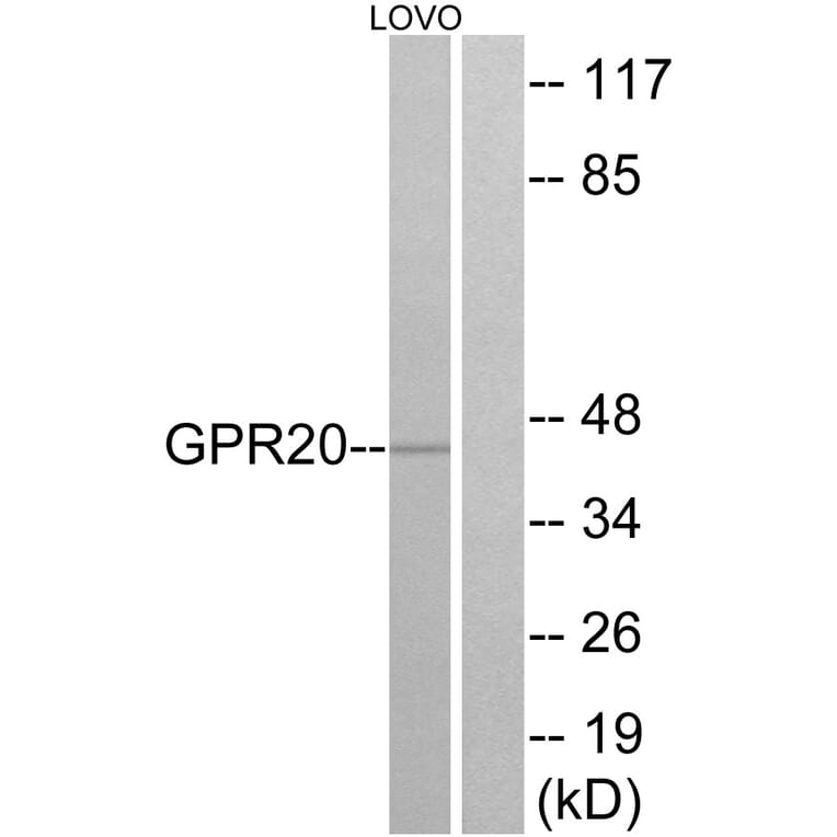 Western Blot - Anti-GPR20 Antibody (G328) - Antibodies.com