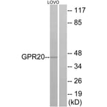 Western Blot - Anti-GPR20 Antibody (G328) - Antibodies.com