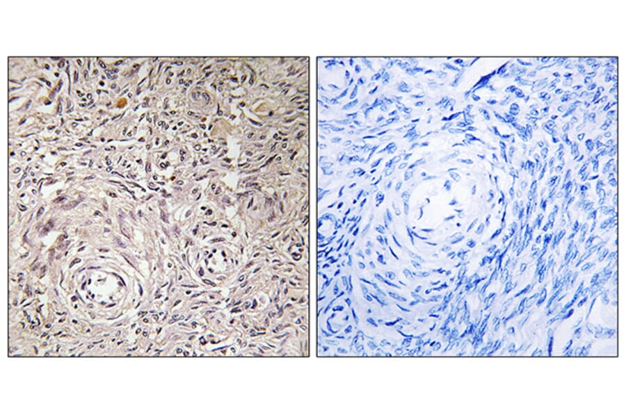 Immunohistochemistry - Anti-GCNT7 Antibody (C14711) - Antibodies.com