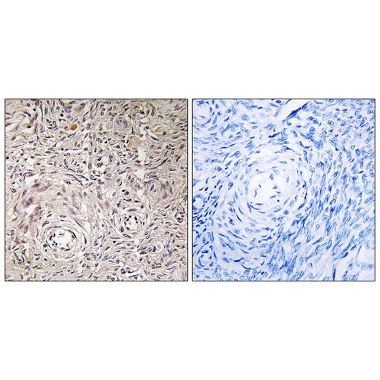 Immunohistochemistry - Anti-GCNT7 Antibody (C14711) - Antibodies.com