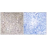 Immunohistochemistry - Anti-GCNT7 Antibody (C14711) - Antibodies.com