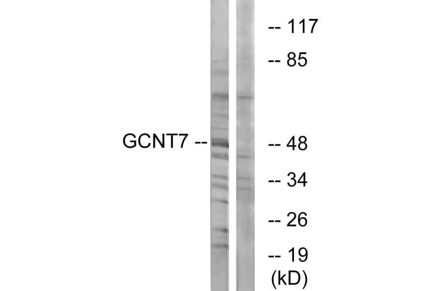 Western Blot - Anti-GCNT7 Antibody (C14711) - Antibodies.com