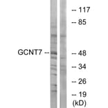 Western Blot - Anti-GCNT7 Antibody (C14711) - Antibodies.com