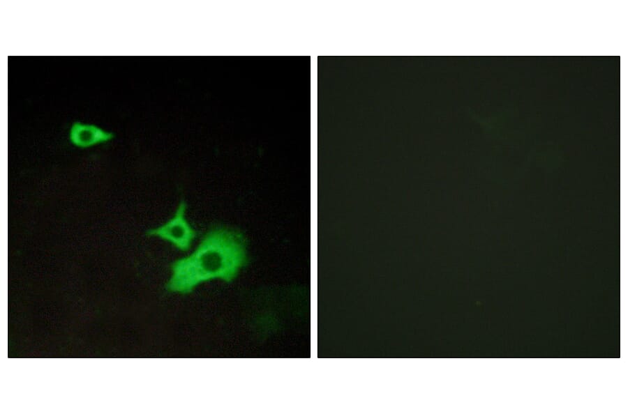 Immunofluorescence - Anti-ETBR2 Antibody (G247) - Antibodies.com