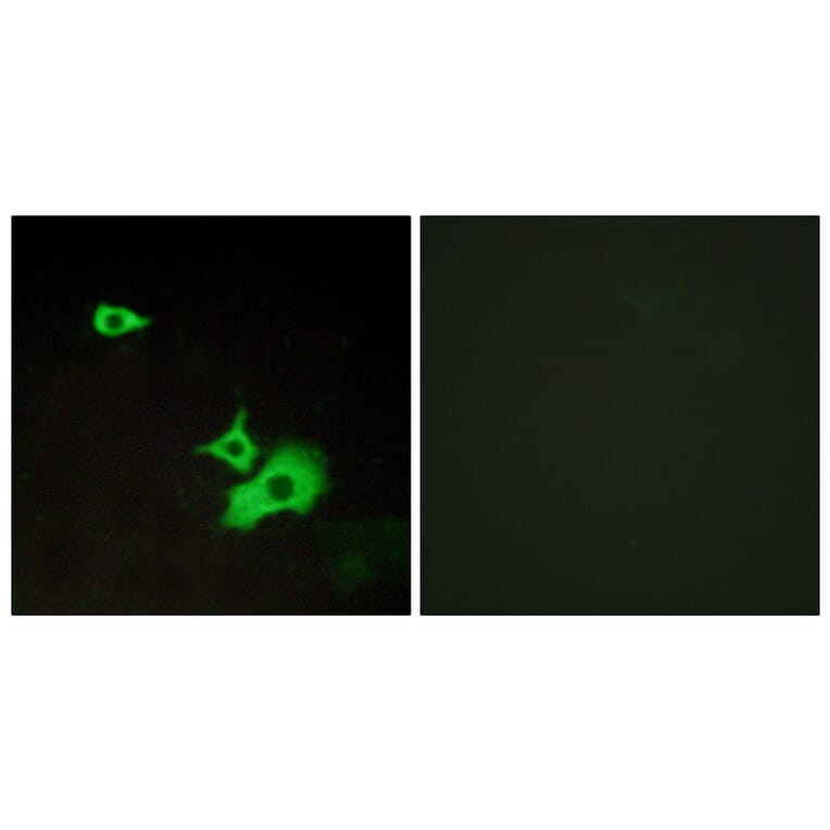Immunofluorescence - Anti-ETBR2 Antibody (G247) - Antibodies.com