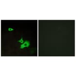 Immunofluorescence - Anti-ETBR2 Antibody (G247) - Antibodies.com