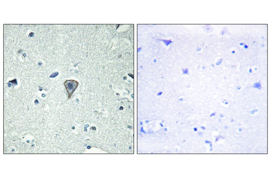 Immunohistochemistry - Anti-ETBR2 Antibody (G247) - Antibodies.com