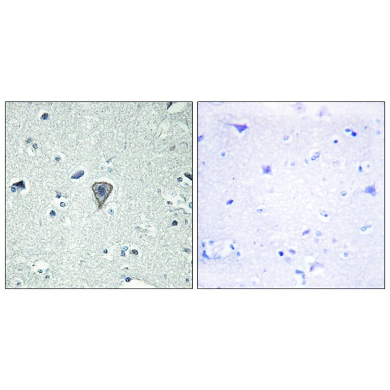 Immunohistochemistry - Anti-ETBR2 Antibody (G247) - Antibodies.com