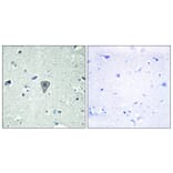 Immunohistochemistry - Anti-ETBR2 Antibody (G247) - Antibodies.com