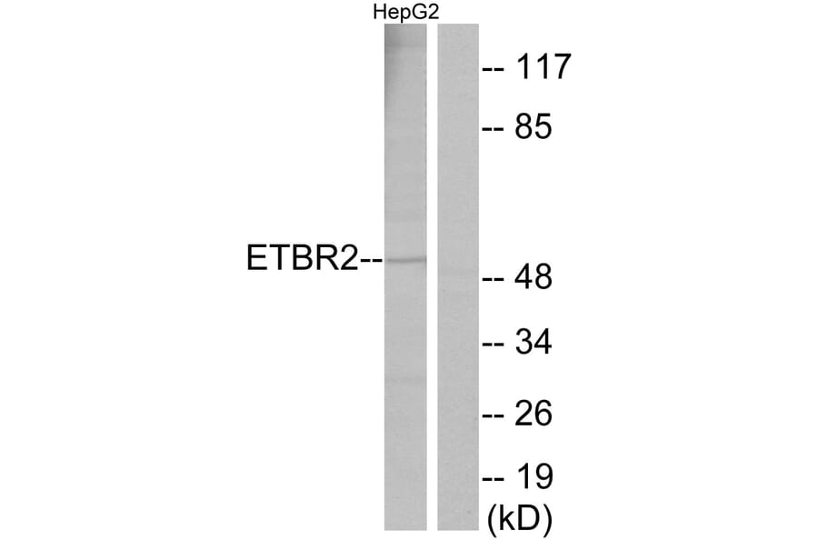 Western Blot - Anti-ETBR2 Antibody (G247) - Antibodies.com