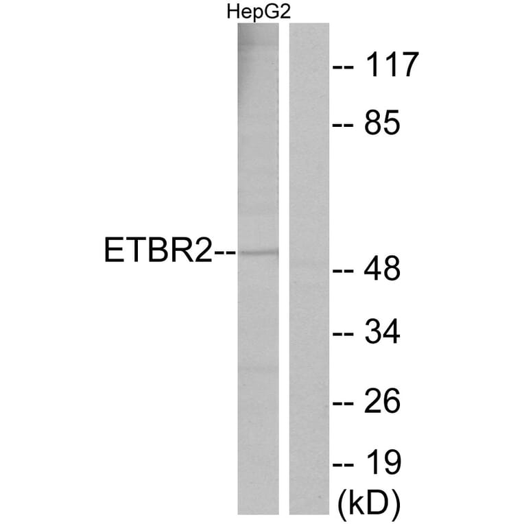 Western Blot - Anti-ETBR2 Antibody (G247) - Antibodies.com