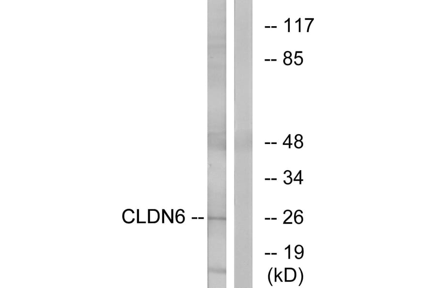 Western Blot - Anti-CLDN6 Antibody (C15161) - Antibodies.com
