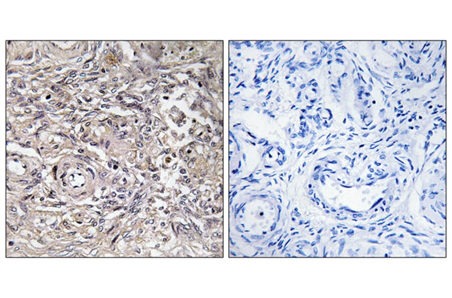 Immunohistochemistry - Anti-CLDN6 Antibody (C15161) - Antibodies.com