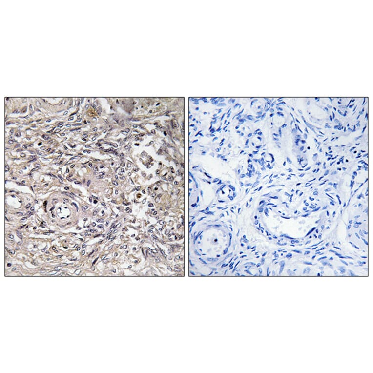 Immunohistochemistry - Anti-CLDN6 Antibody (C15161) - Antibodies.com