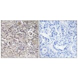 Immunohistochemistry - Anti-CLDN6 Antibody (C15161) - Antibodies.com