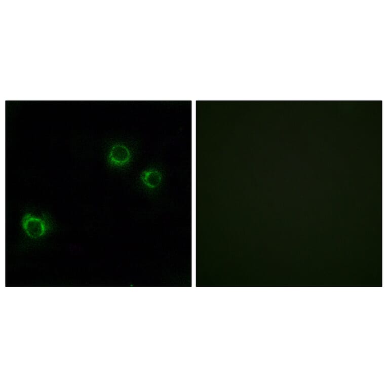 Immunofluorescence - Anti-CLDN6 Antibody (C15161) - Antibodies.com