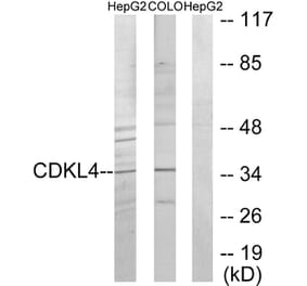 Western Blot - Anti-CDKL4 Antibody (C11182) - Antibodies.com