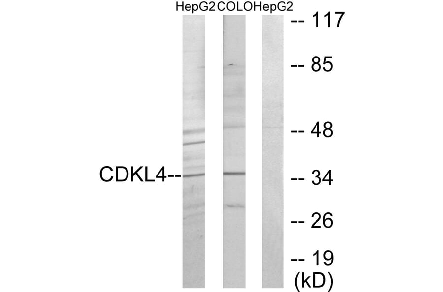 Western Blot - Anti-CDKL4 Antibody (C11182) - Antibodies.com