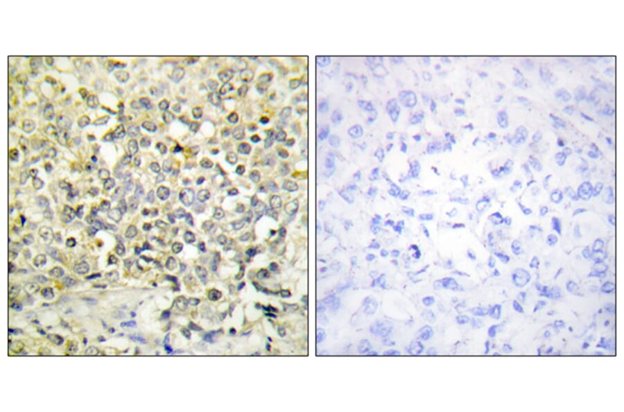 Immunohistochemistry - Anti-CDKL4 Antibody (C11182) - Antibodies.com