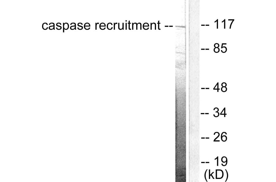 Western Blot - Anti-CARD6 Antibody (C0136) - Antibodies.com