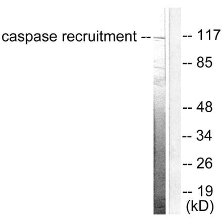 Western Blot - Anti-CARD6 Antibody (C0136) - Antibodies.com