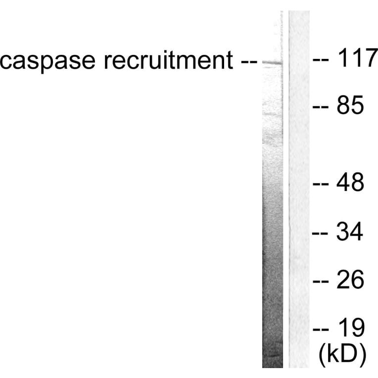 Western Blot - Anti-CARD6 Antibody (C0136) - Antibodies.com