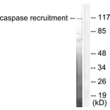 Western Blot - Anti-CARD6 Antibody (C0136) - Antibodies.com
