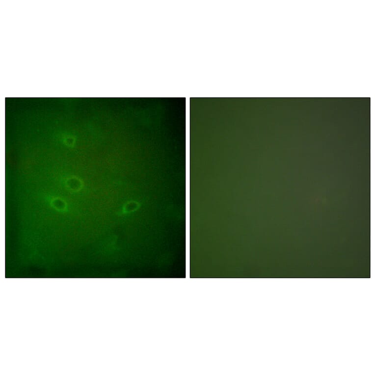 Immunofluorescence - Anti-CARD6 Antibody (C0136) - Antibodies.com