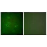 Immunofluorescence - Anti-CARD6 Antibody (C0136) - Antibodies.com