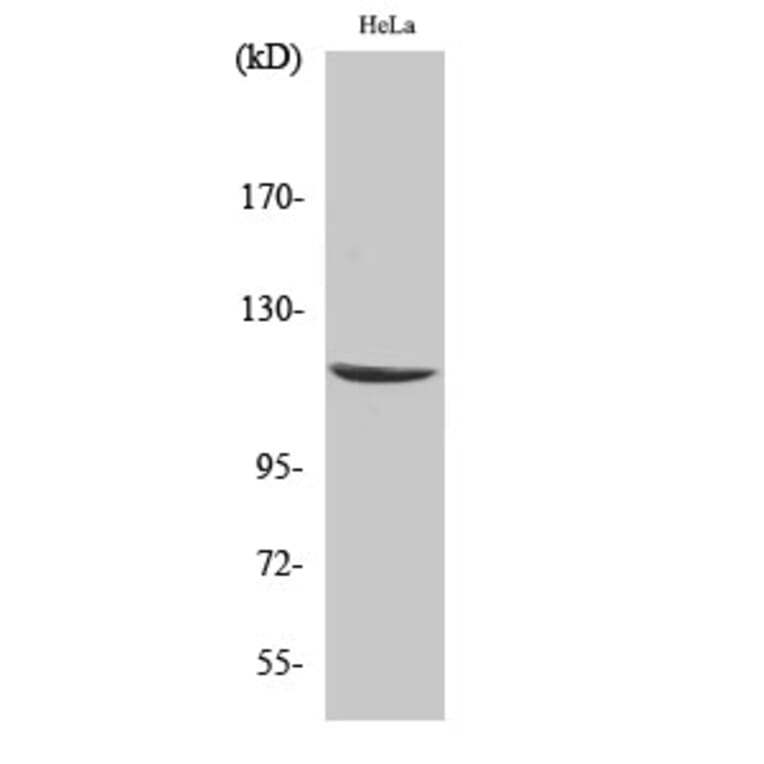 Western Blot - Anti-CARD6 Antibody (C0136) - Antibodies.com