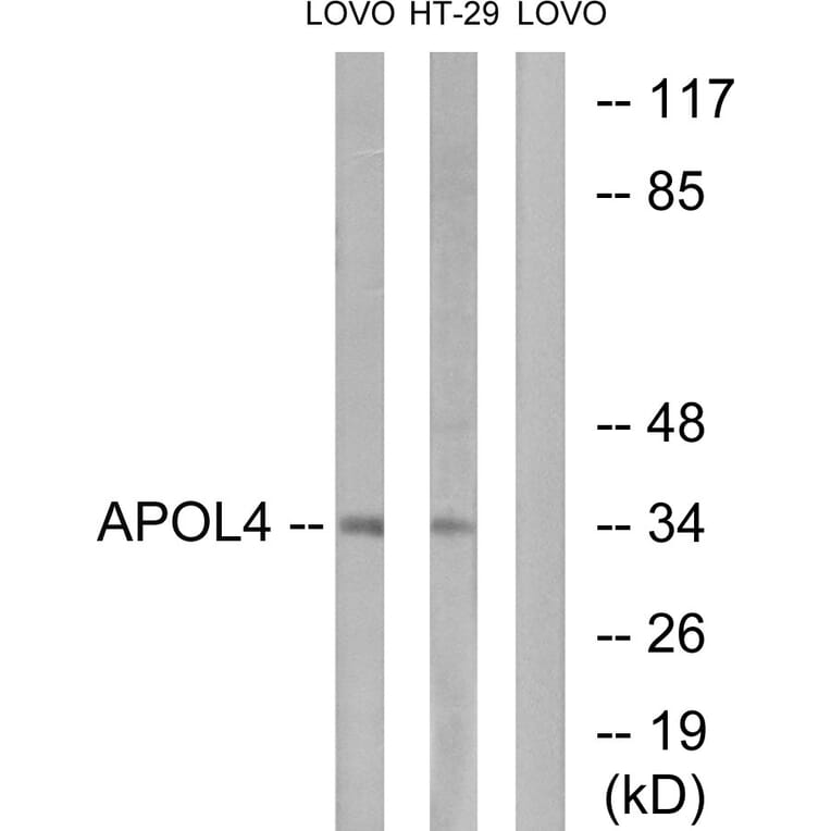 Western Blot - Anti-APOL4 Antibody (C14542) - Antibodies.com