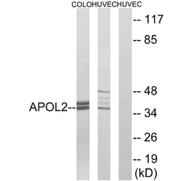 Western Blot - Anti-APOL2 Antibody (C14540) - Antibodies.com