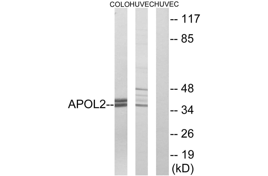 Western Blot - Anti-APOL2 Antibody (C14540) - Antibodies.com