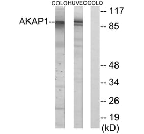 Western Blot - Anti-AKAP1 Antibody (C11427) - Antibodies.com