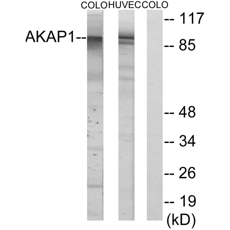 Western Blot - Anti-AKAP1 Antibody (C11427) - Antibodies.com