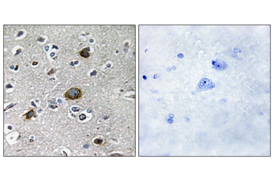 Immunohistochemistry - Anti-AKAP1 Antibody (C11427) - Antibodies.com