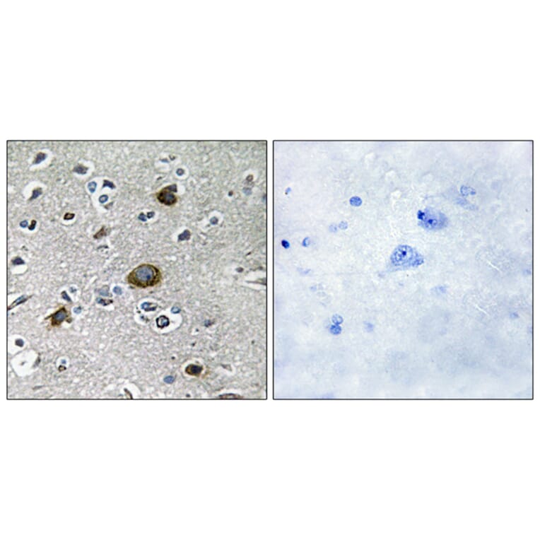 Immunohistochemistry - Anti-AKAP1 Antibody (C11427) - Antibodies.com