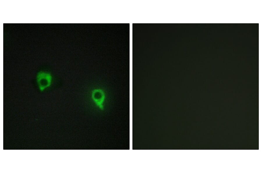 Immunofluorescence - Anti-AKAP1 Antibody (C11427) - Antibodies.com
