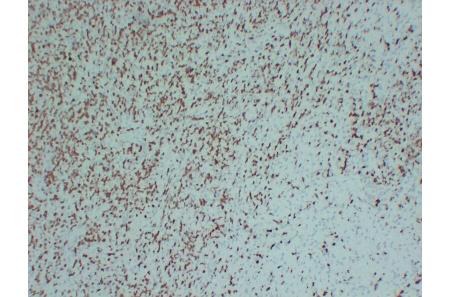 Immunohistochemistry - Anti-ZAP70 Antibody (V0141) - Antibodies.com