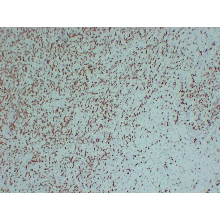 Immunohistochemistry - Anti-ZAP70 Antibody (V0141) - Antibodies.com