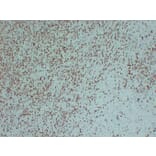 Immunohistochemistry - Anti-ZAP70 Antibody (V0141) - Antibodies.com