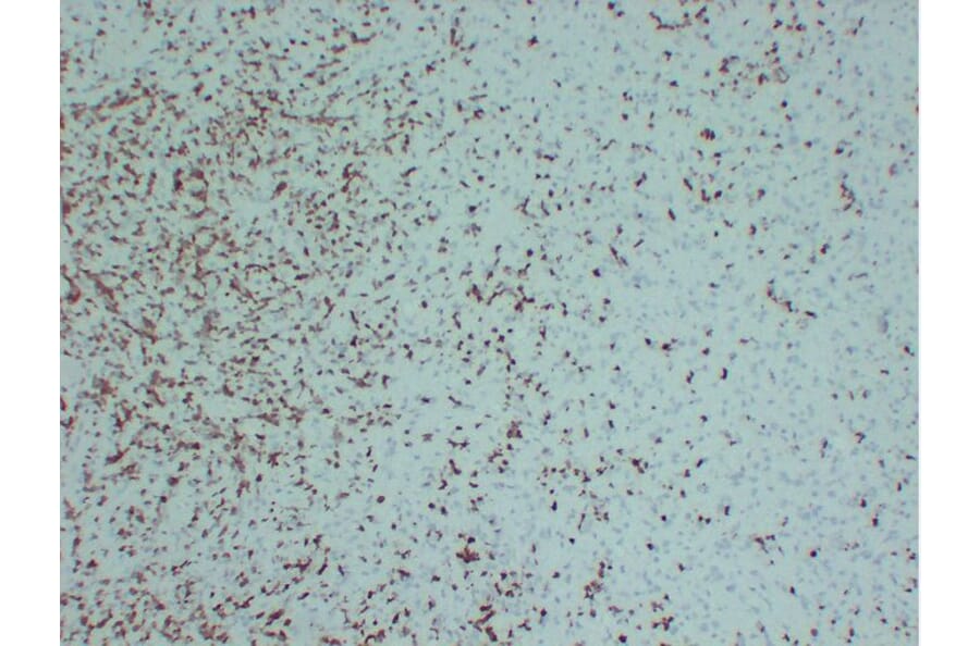 Immunohistochemistry - Anti-ZAP70 Antibody (V0141) - Antibodies.com