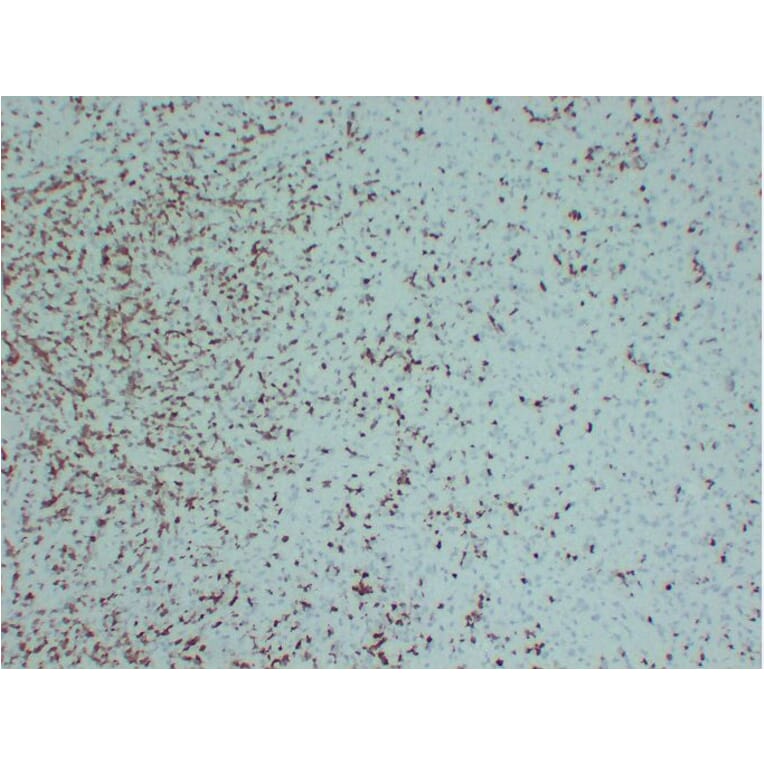 Immunohistochemistry - Anti-ZAP70 Antibody (V0141) - Antibodies.com